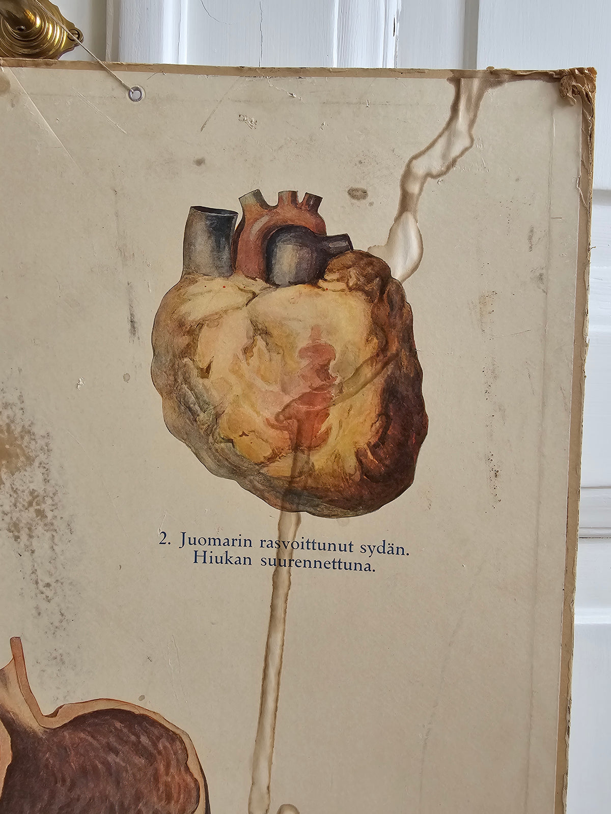 Valistuksen raittiusanatominen kuvasarja Nro. 1