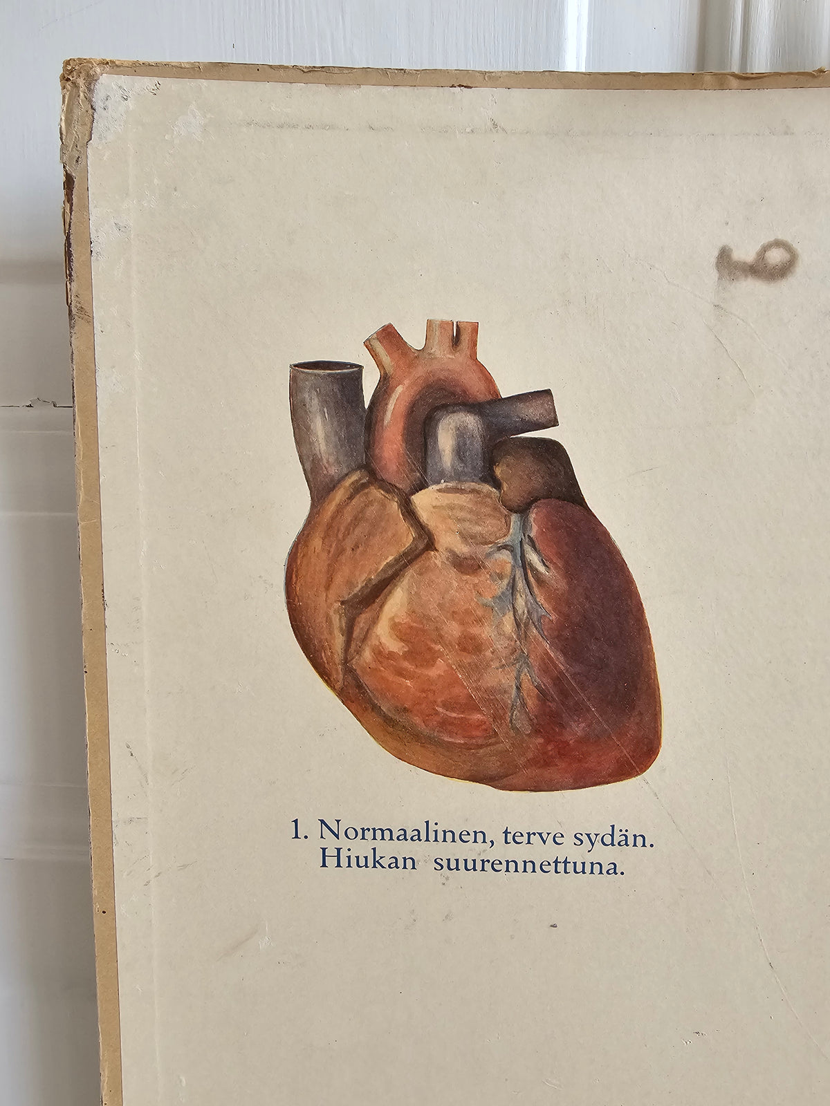 Valistuksen raittiusanatominen kuvasarja Nro. 1