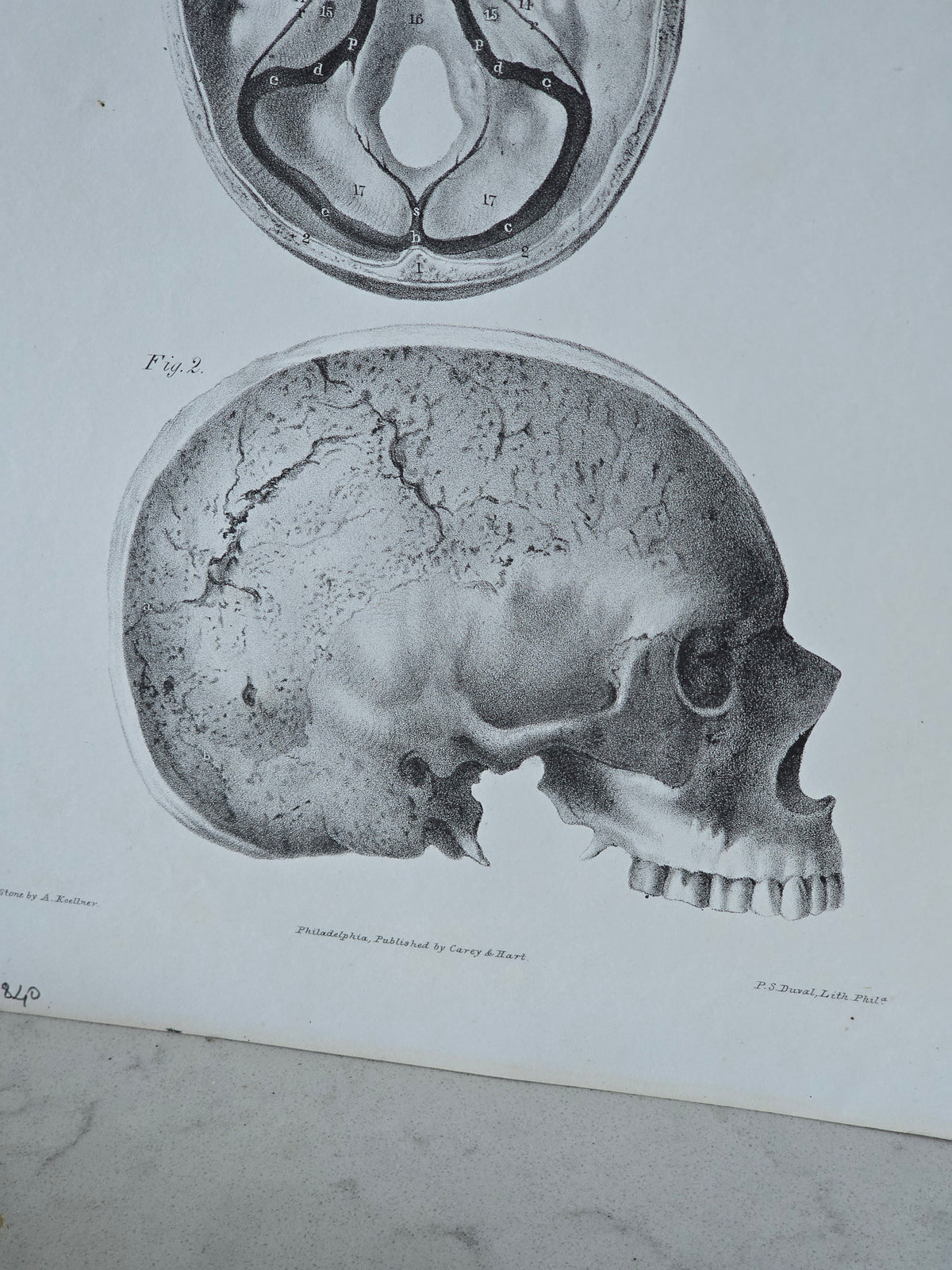 Vanhat v. 1840 anatomiset litografiat