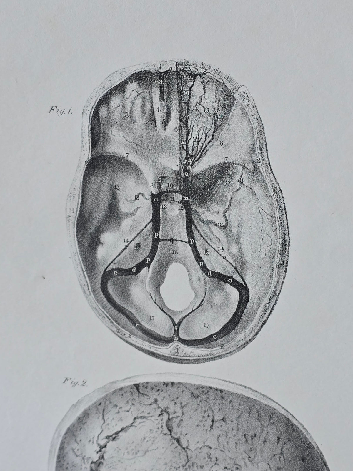 Vanhat v. 1840 anatomiset litografiat