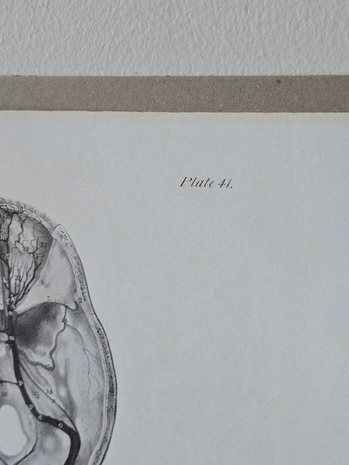 Vanhat v. 1840 anatomiset litografiat
