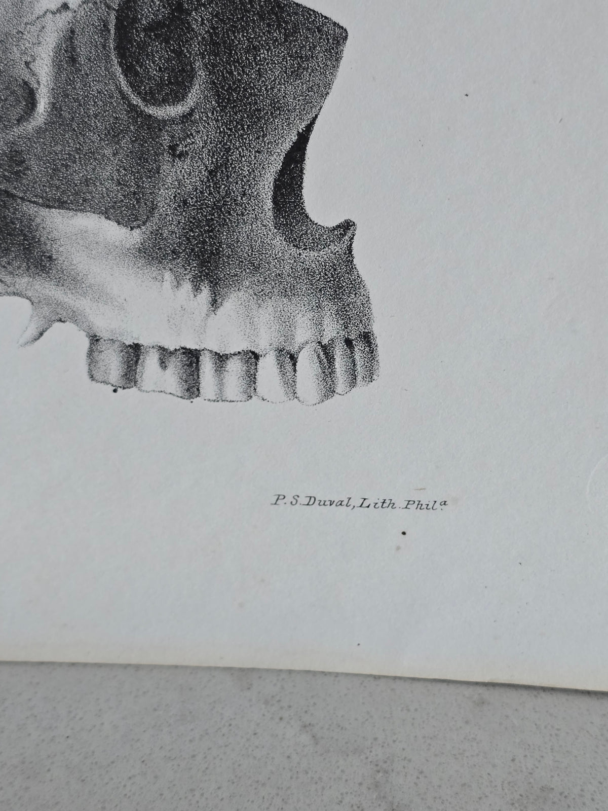 Vanhat v. 1840 anatomiset litografiat